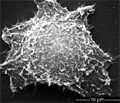 Gold Nanorods to be Used to Treat Cancer