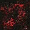 Nanoparticles Present in Food May Affect Human Intestinal Villi