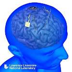 DARPA Awards Lawrence Livermore Lab $5.6 Million for Development of Implantable Neural Interface