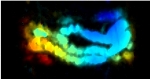 Researchers Develop New Nanoscale Agent for Imaging the GI Tract
