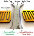 Contact-Free Microfluidic System Uses Acoustic Tweezers to Isolate Circulating Tumor Cells