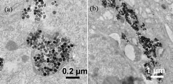 Rotating Magnetic Nanoparticles Could Mechanically Destroy Cancer Cells