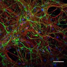 New Carbon Nanotubes Show Promise for Repairing Injured Nerve Tissues