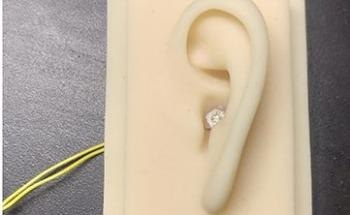 New Device Developed for Treating Hearing Loss