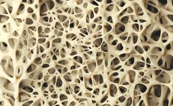 Nanocomposite Hydrogel Improves Bone Repair Treatment
