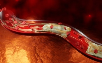 Nanotubes Aid Non-Enzymatic Sensing of Cholesterol