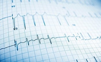 New Technique to Construct Dry Electrodes for ECG Monitoring