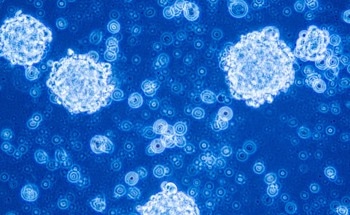 Engineered Nanoparticles Form Nanoplatform to Target Glioblastoma