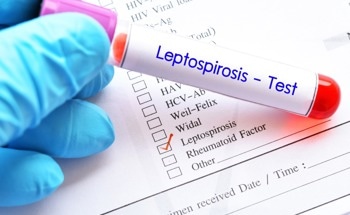 Early Diagnosis of Leptospirosis Using Au Nanoparticle Sensor