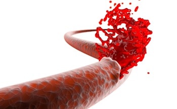 Nanofiber Aerogel to Control Bleeding from Penetrating Wounds