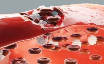 Evaluating the Wound Healing Ability of Bioactive Glass