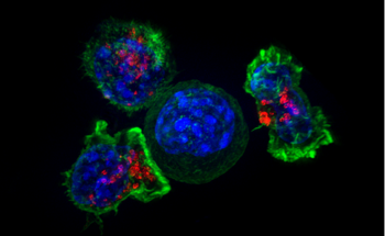 Advanced Nanoparticles Provide New Weapon to Fight Difficult Cancers
