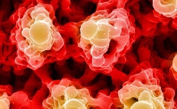 Nanotechnology Platform can Make Cancer Cells More Receptive to Immunotherapy