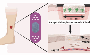 Nanofiber Aerogels for Rapid Diabetic Wound Healing