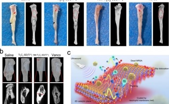 Tackling Bone Tissue Infection with 2D Ultrasound-Responsive Antibacterial Nanosheets