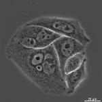 Axio Vert.A1 Microscope Images HeLa Cells  