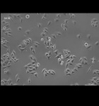 HeLa Cells Imaged Using Axio Vert.A1 Microscope   